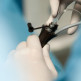 Wanneer wordt een laparoscopie uitgevoerd?