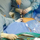 Complicaties bij laparoscopie